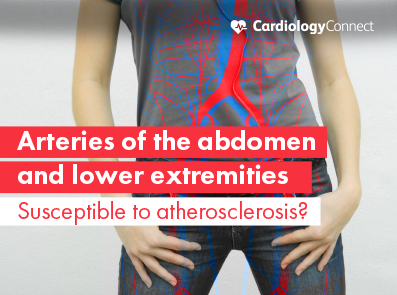 Do You Know the Distribution Pattern of Atherosclerosis in the Abdomen and Lower Extremities?